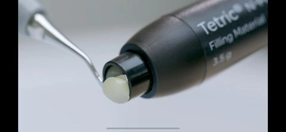 Ivoclar TETRIC N CERAM-2 – Image 2